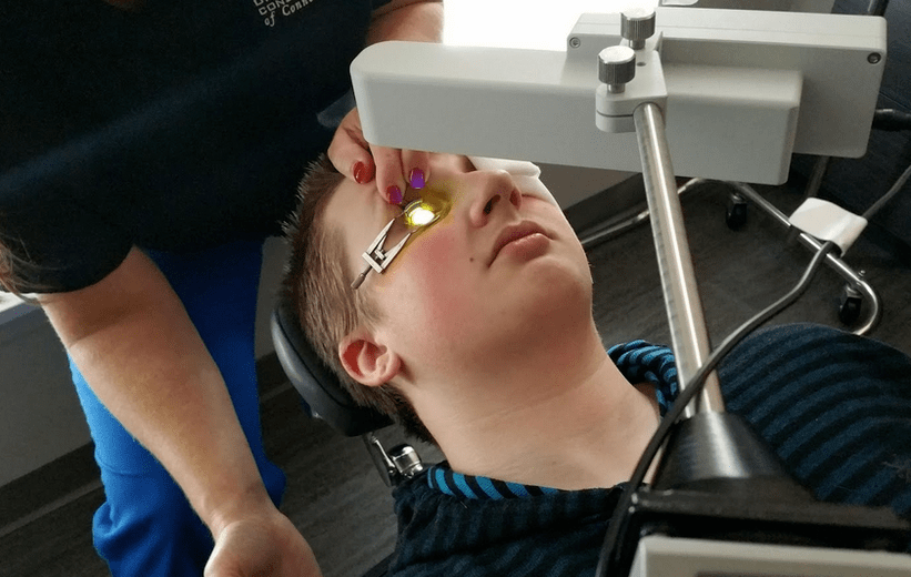 Reticulation effectively eliminates keratoconus at the beginning of its development
